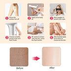 IPL Laser hair removal device