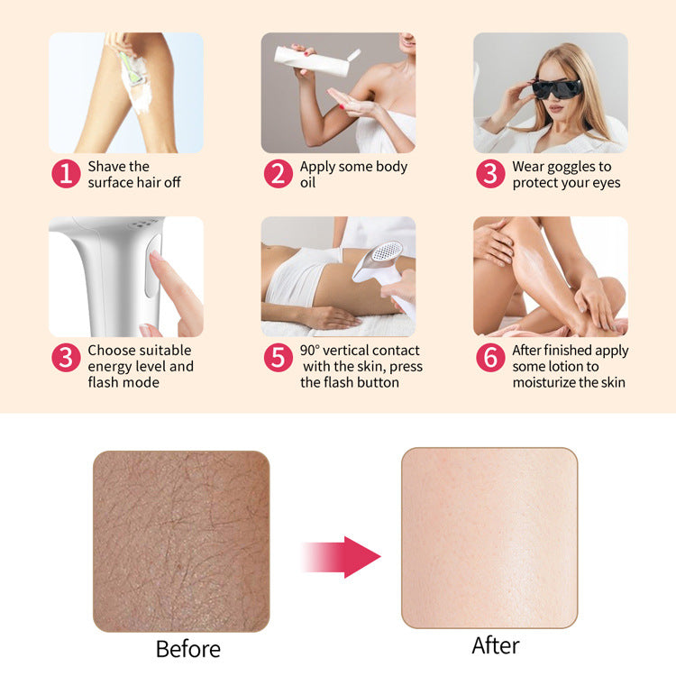 IPL Laser hair removal device